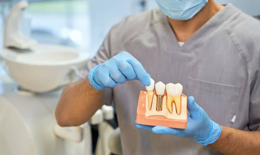 The Benefits of Dental Implants