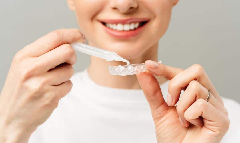 Teeth Whitening