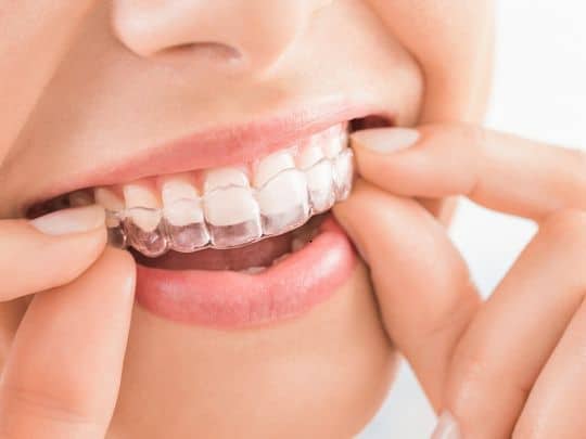 Invisalign treatment in Hot Springs
