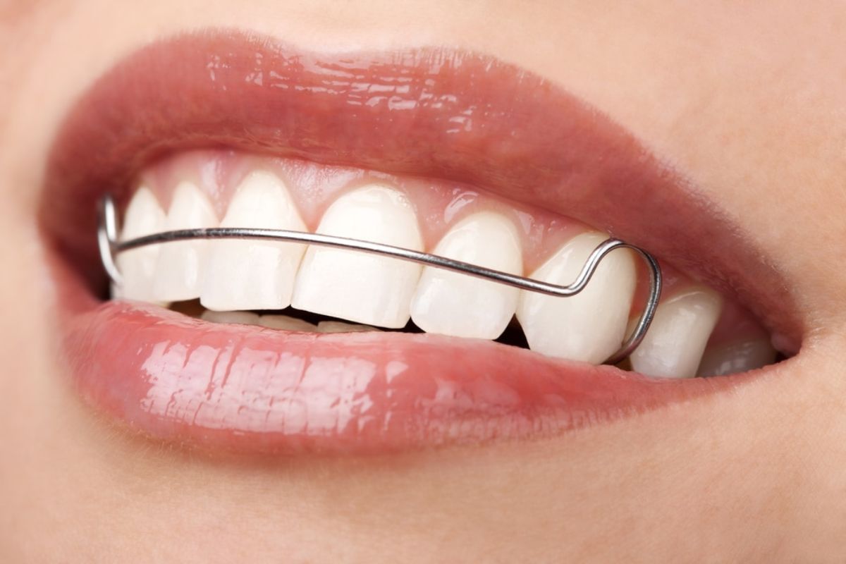 orthodontist in Hot Springs