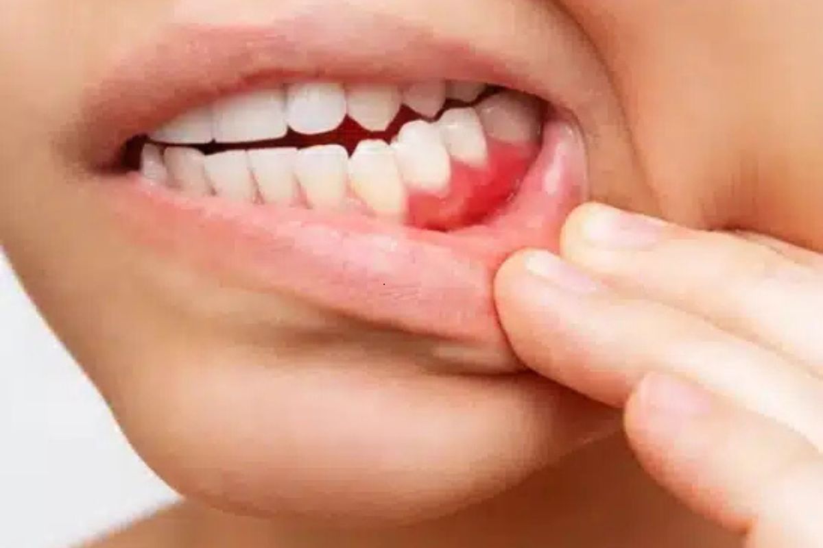periodontal treatment hot springs