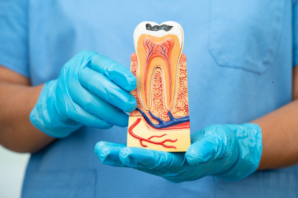 How to Care for Your Tooth After Root Canal Therapy