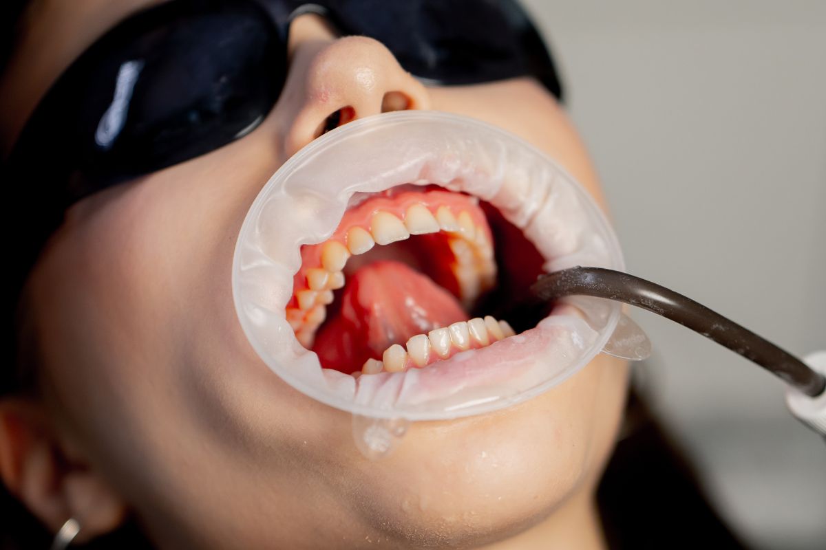 Gum Health Matters and How a Dentist hot-springs Help