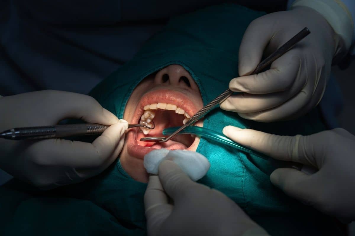 Teeth Diseases & Treatment